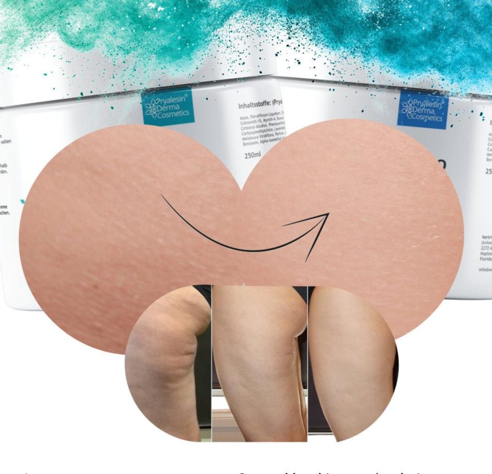 MyNaturalSecret - Pryalesin PROCELL 2 Day+Night Typ 1 - 3 Cellulite